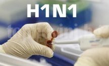 25 души в Украйна починаха от свински грип