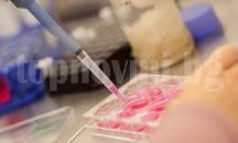 Кампания за ранна диагностика на рак започва във Варна и Добрич