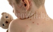 Нови 31 случая на дребна шарка установиха в област Плевен