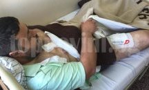 Разследват собственика на питбулите нахапали хора в Казанлък