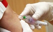 Болестта на Алцхаймер ще се открива само по капка кръв
