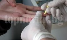Произволно избрани 2000 души ще се изследват безплатно срещу хепатит C