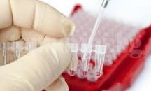 Последен ден на безплатно изследване за ХИВ в Сливен