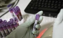 В Плевен започва акция за безплатно изследване на кожни алергии