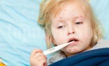 34 нови случая на варицела в Плевенско