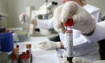 Бум на заболелите от варицела в Бургаска област