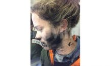 Млада жена с изгаряния, заради избухнали слушалки