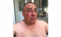 Скандал и побой на кооперативния пазар в Шумен вкара търговец в болница