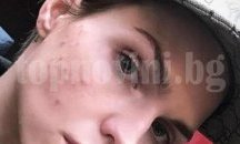 Руби Роуз има акне от даване на интервюта