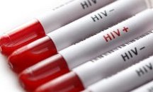 Увеличават се новите случаи на зараза с вируса ХИВ в Източна Европа