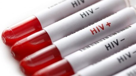 Учени от Барселона с пробив в борбата с ХИВ
