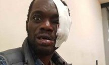 Чернокож британец пребит от ултраси, БХК поема защитата му