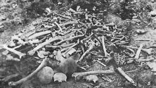 Останки от избити арменци в Ерзинджан. Подобни гледки можели да се видят навсякъде из Армения.