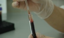 Откриха метод за предотвратяване образуването на метастази