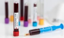 41 са новите случаи на COVID-19 у нас