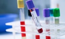 Процентът на положителните проби се увеличава