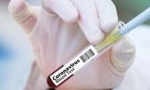 Прокуратурата пита: как се контролира използването на бързите тестове за коронавирус