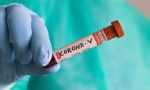 Купуваме 30 000 теста за коронавирус и над 2 млн. маски