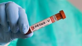 Коронавирусът у нас: 81 нови случаи