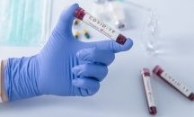 Заплатен PCR тест не ни осигурява прием в болница