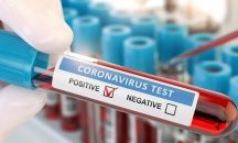 Нови 17 контактни лица са установени с COVID-19 в Сърница