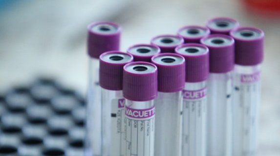 Трима футболисти от Локо Горна Оряховица са с коронавирус