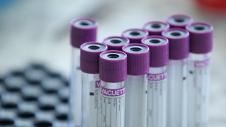 Трима футболисти от Локо Горна Оряховица са с коронавирус
