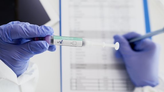 Два пъти по-малко заразени с COVID-19 у нас от началото на май