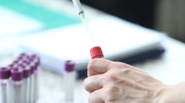 Новите случаи на COVID-19 паднаха под 100