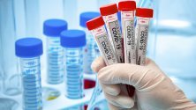 СБЛЪСЪК: Да се правят ли PCR тестове на всички, които влизат в болница?