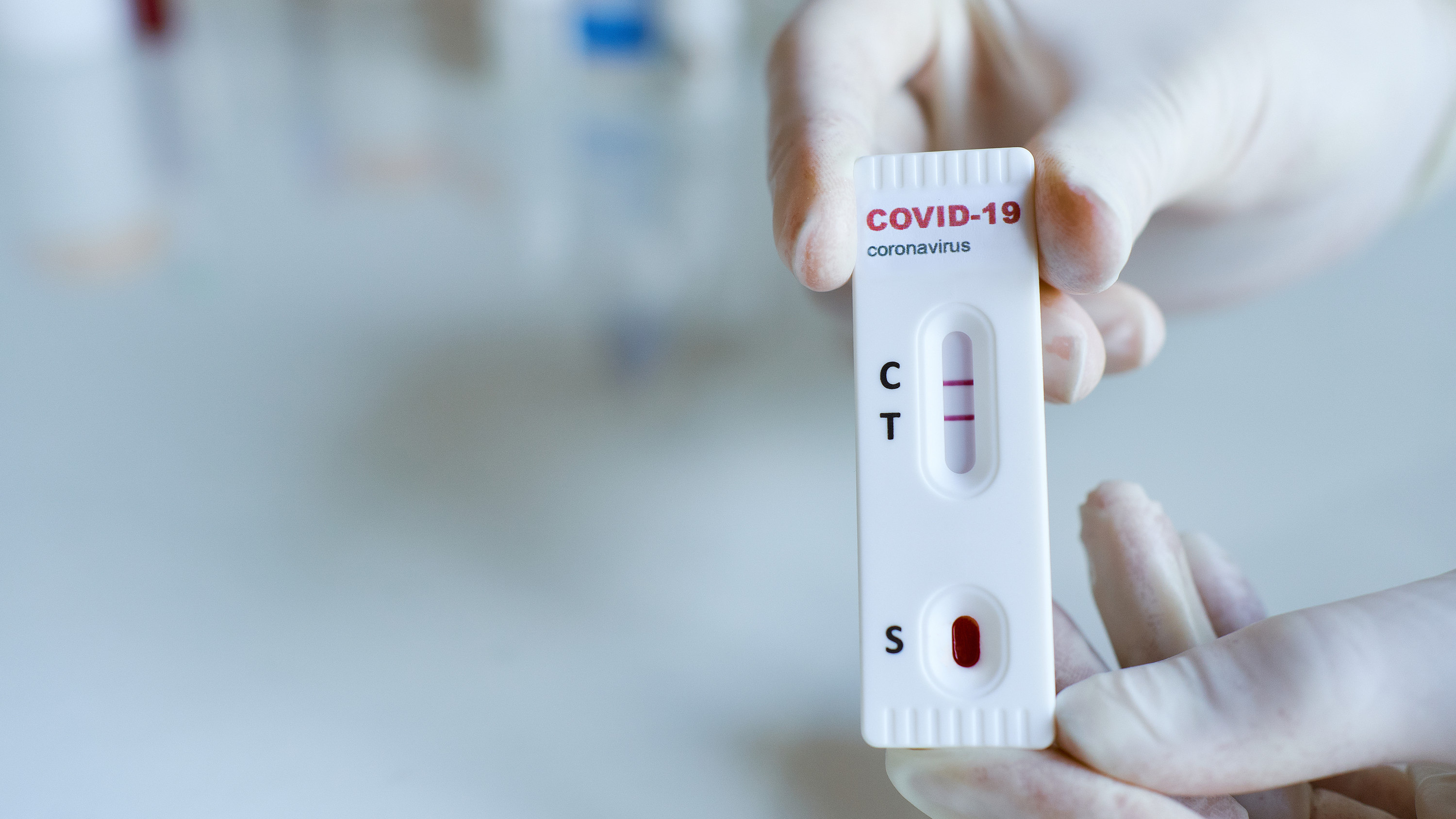 Тест дрожь. Rapid Test covid19. Covid-19 antigen Rapid Test. Экспресс-тест на Covid-19 antigen Rapid Test Kit. Covid 19 Test.