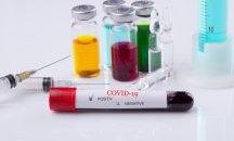 255 нови случая на COVID-19