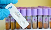 Предлагат антигенните тестове да са безплатни